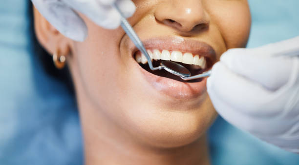Best Emergency Dental Care for Sports Injuries in Monte Sereno, CA