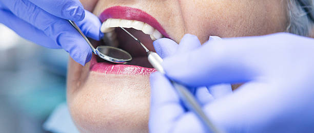 Best Emergency Dental Care for Sports Injuries in Monte Sereno, CA